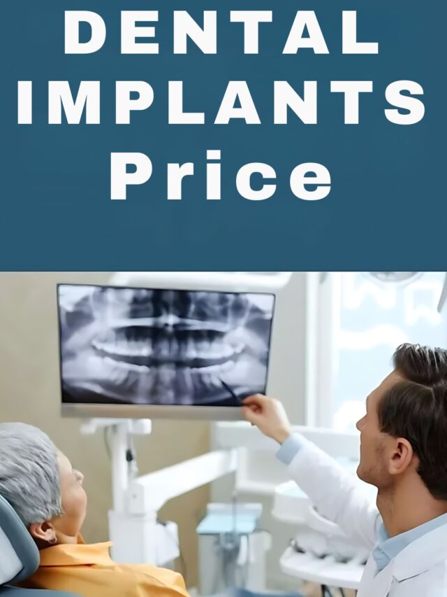 The Cost Of Full Mouth Dental Implants In Various Places: Invest In Your Smile